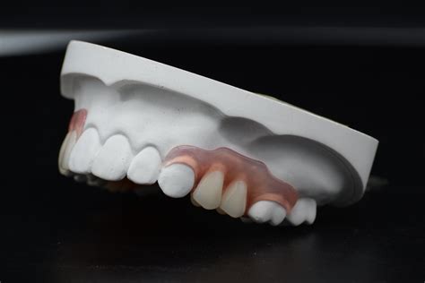 Strong And Durable Valplast Flexible Dentures Dental Partials Denture