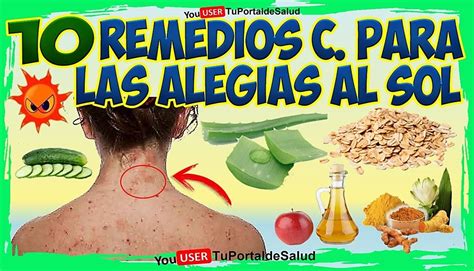 10 Remedios Para Alergias Del Sol Remedios Caseros Para Las Alergias En