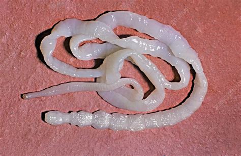 Tapeworm Stock Image C003 9754 Science Photo Library