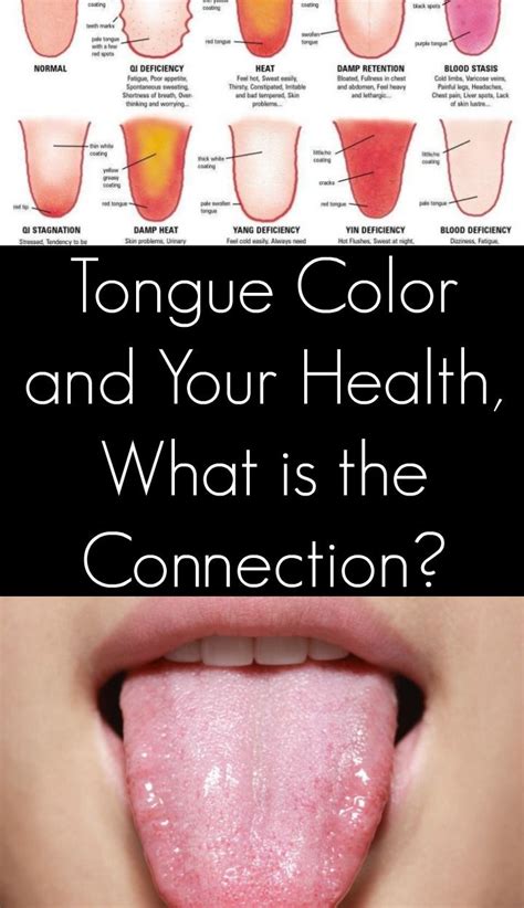 Tongue Color And Your Health What Is The Connection Health Healthy