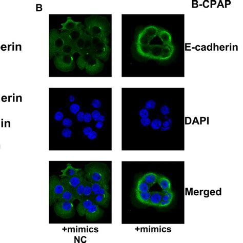 mir‐451a inhibits epithelial‐mesenchymal transition of papillary download scientific diagram