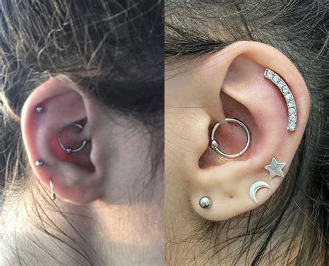 I Originally Got My Daith Pierced 4 Months Ago Mid September Pictured On Left But I Think My