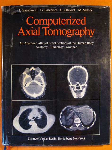 Computerized Axial Tomography An Anatomic Atlas Of Serial Sections Of