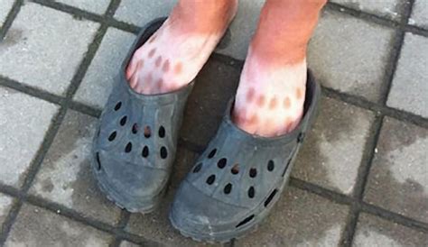 20 Hilarious Tan Lines That Ll Make You Never Want To Step Outside Again