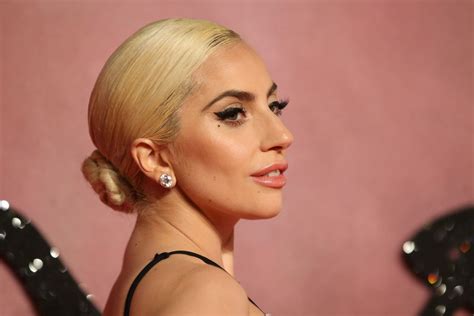 Lady Gaga Discusses Ptsd Struggle In Open Letter The Boston Globe