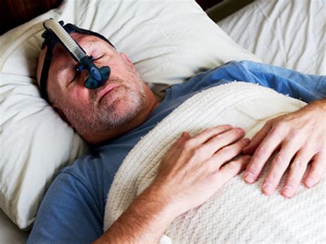 Sleep Apnea Pacemaker Zaps Tongue For Better Sleep Will It Work