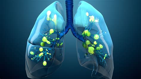 Common Lung Diseases Alphanet