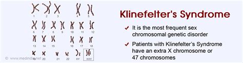 klinefelter syndrome causes symptoms diagnosis treatm