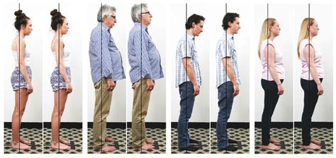 Our Posture Focus Posture Correction Kirsh Chiropractic