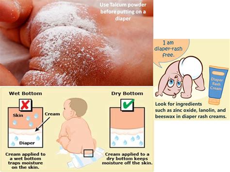 What Causes Diaper Rashes