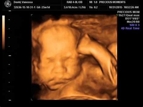 25 weeks 4d ultrasound
