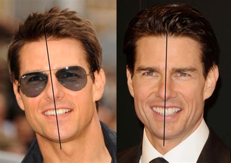 Tom Cruise Teeth Before After