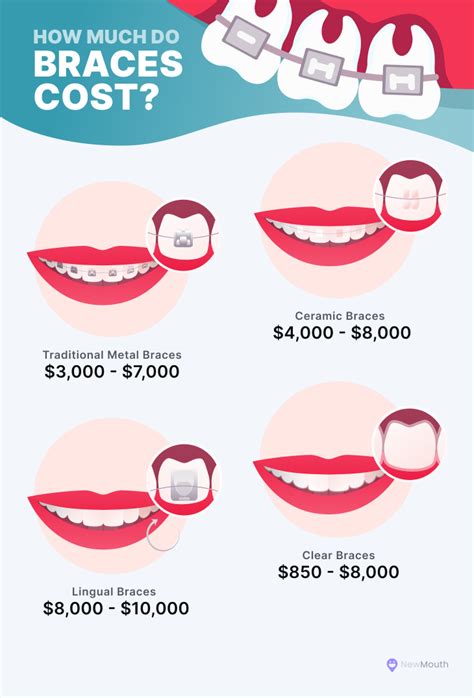 Clear Braces Costs 6 Best Brands Pros And Cons