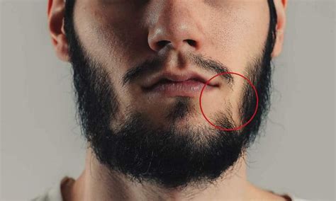 7 Ways To Fix A Beard Not Connecting To Mustache And Sideburns Beard No