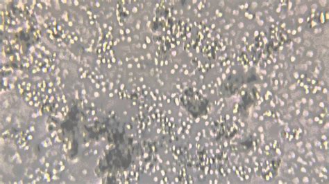 Yeast Cells Under Microscope 1000x