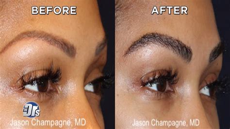 Jason champagne talk about her transformative eyebrow transplant. The Doctors - Actress Meagan Good's Mind-Blowing Eyebrow ...