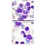 Figure 16 From Plasma Cell Morphology In Multiple Myeloma And Related 