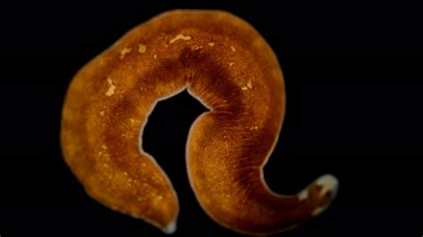 Platyhelminthes Flatworm Under A Microscope A Type Of Protostomia