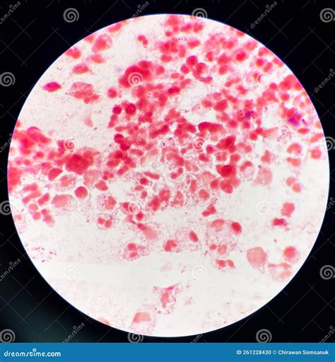 Red Cell D Shape Gram Negative Diplococci In Vaginal Smear Stock Photo