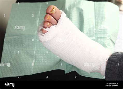 Un Uomo Con Un Bendato Piede Diabetico E Infezione Toenail Fungo Foto Stock Alamy