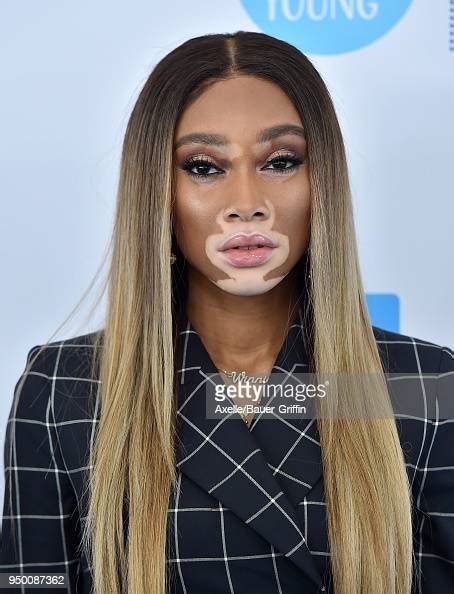 Model Winnie Harlow Attends We Day California At The Forum On April