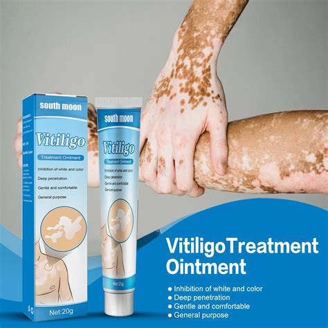 Powerful Herbal Extract Vitiligo Ointment Remove Ringworm White Spot