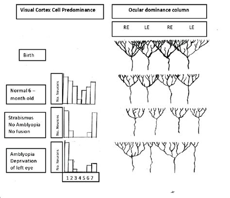 Ocular Dominance Columns Download Scientific Diagram