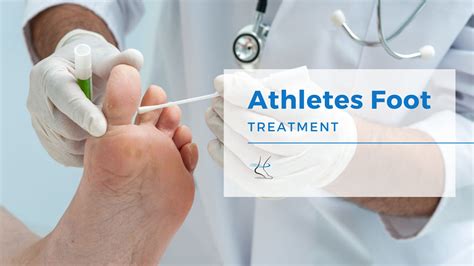 Athletes Foot Medical Treatment Moore Foot And Ankle Specialists