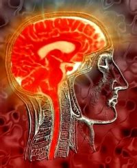 La combinazione di stimolazioni magnetiche cerebellari e la neuroriabilitazione vestibolare accelera il recupero del cammino e dell'equilibrio in soggetti con sclerosi multipla. Scoperti due virus che scatenano la sclerosi multipla ...