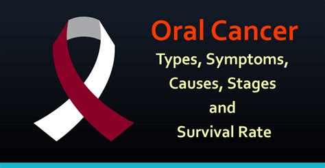 Oral Cancer Types Symptoms Causes Stages Preventions And Treatments