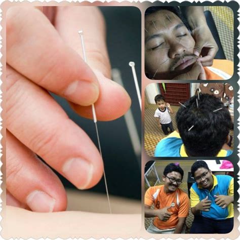 Bekam Waghih Rawatan Rumah Ke Rumah Cupping Therapy In Senawang