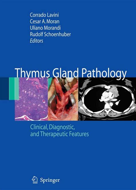 Enlarged Thymus Gland In Adults