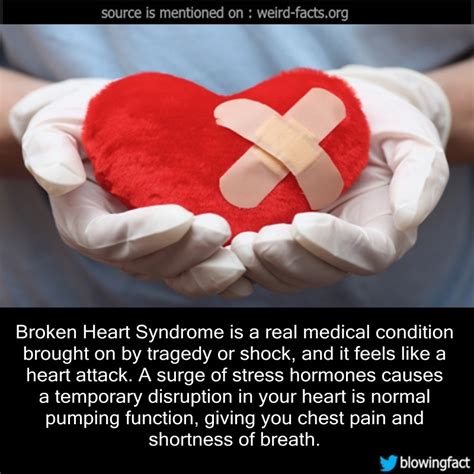 Weird Facts Broken Heart Syndrome Is A Real Medical Condition