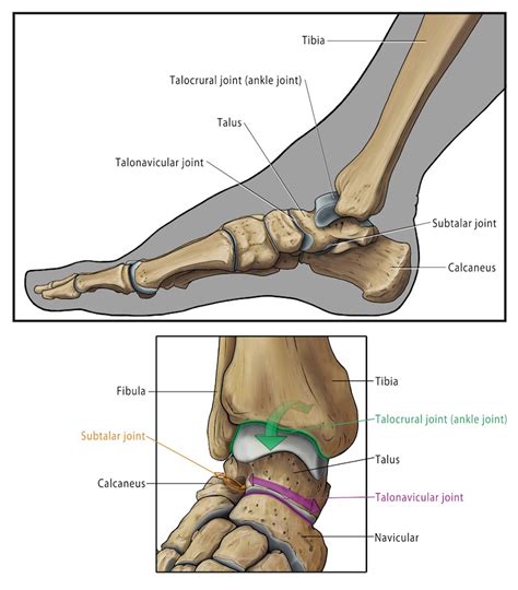 Ankle Arthritis — Ankle Arthritis Ankle Replacement Arthrodesis
