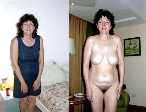 before after granny 241 pics 3 xhamster