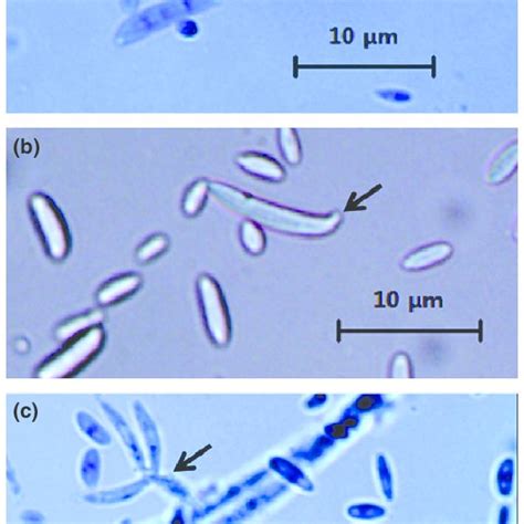 Microscopic Characteristics Of Fusarium Oxysporum A F Oxysporum