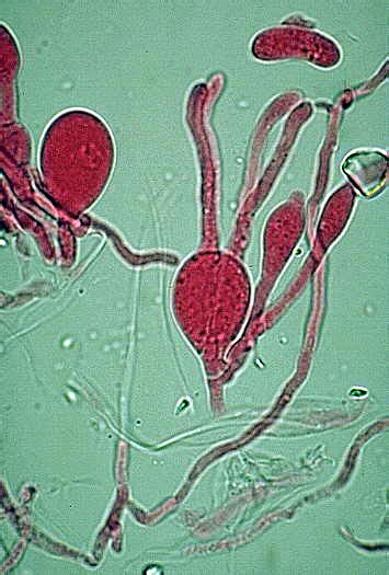 Basidiomycota Microscope Hot Sex Picture