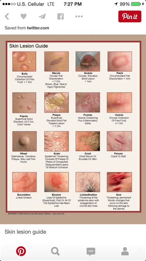 Skin Lesion Description Chart