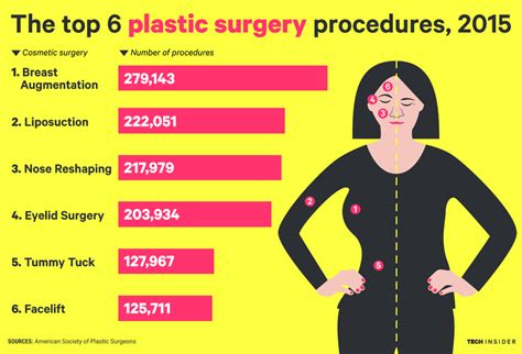 Americans Got Millions Of Plastic Surgeries Last Year Heres What