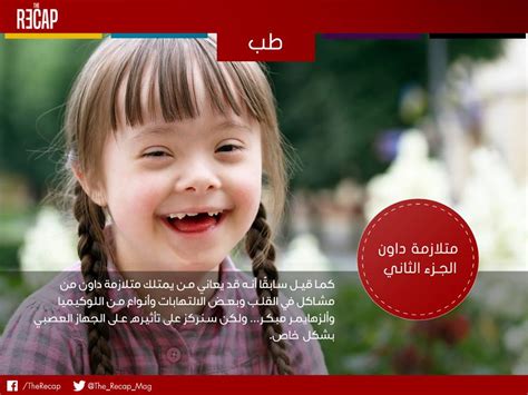 سنتحدث اليوم حول اطفال متلازمة داون حديثي الولاده , يوجد بعض الأطفال الذين يحملون بعض الصفات المختلفة عند الولادة سواء في الشكل الخارجي أو الداخلي وهذه الأعراض ترجع إلى حدوث. متلازمة داون الجزء الثاني | TheRecap