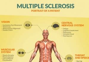 Multiple sclerosis (ms) is a chronic, inflammatory, noninfectious disease that affects the central nervous system (cns). What an MRI identifies for confirming and monitoring ...
