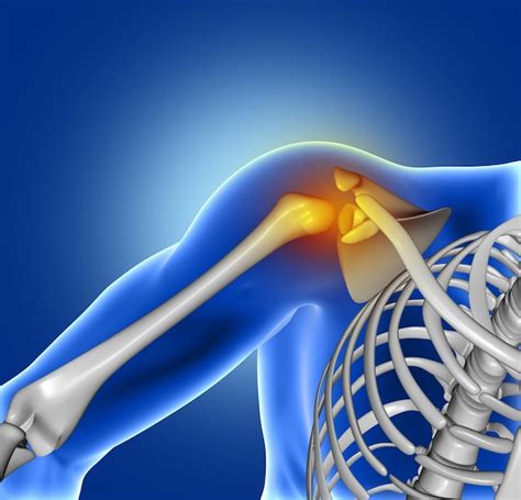 Free Photo Pain Of Shoulder Joint