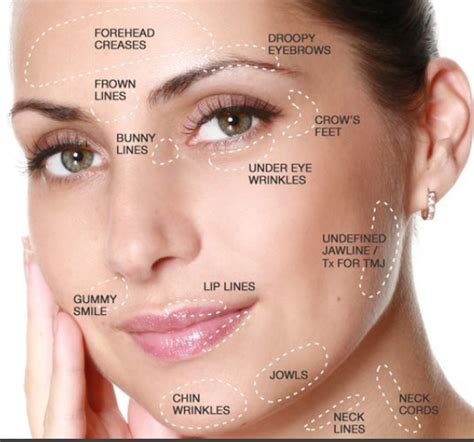 Welcome To Under Eye Wrinkles Facial Aesthetics Botox Injections