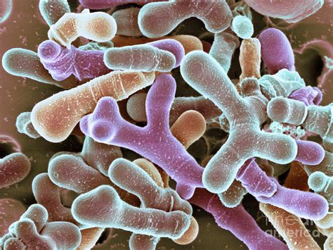 Bifidobacterium Animalis Bacteria Photograph By Dennis Kunkel