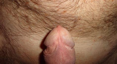 Frenulum For Only Uncut 22 Pics Xhamster