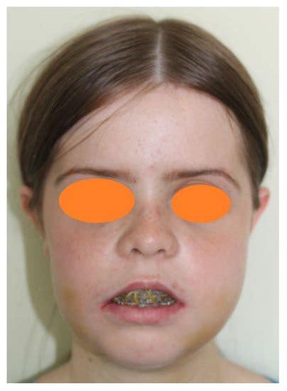 Medicina Free Full Text Substantial Improvements In Facial