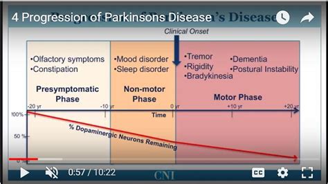 Parkinsons Disease Educational Video