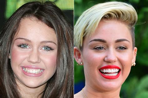 celebrities gone dental before and after photos of toothy transformations huffpost entertainment