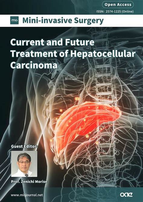 Topic Current And Future Treatment Of Hepatocellular Carcinoma