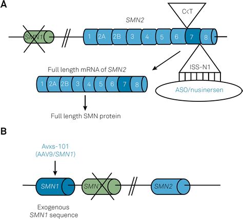 Scielo Brasil Therapeutic Advances In 5q Linked Spinal Muscular